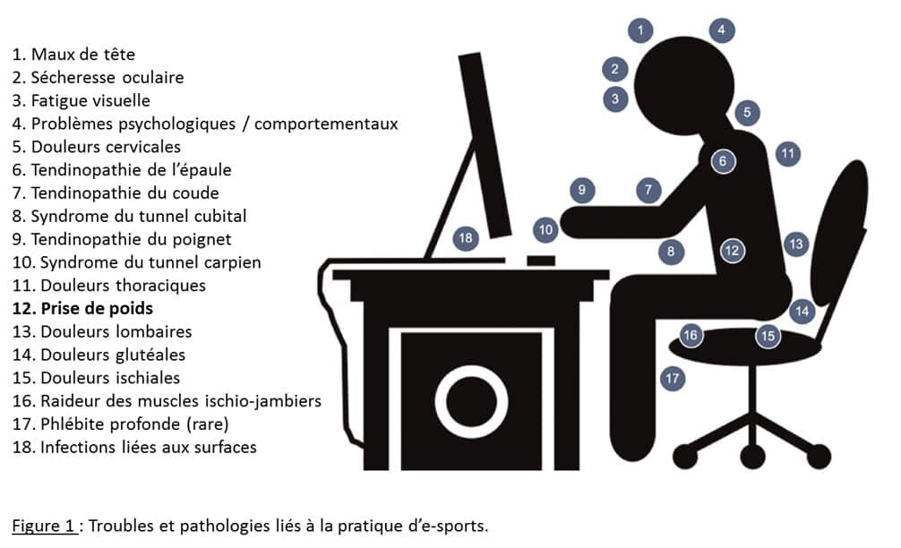 E-sports : les recommandations en termes de nutrition et d’activité physique