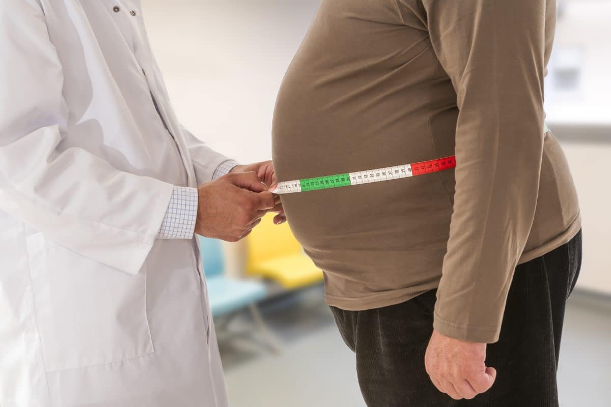 Obésité sarcopénique : un consensus international sur les critères de diagnostic